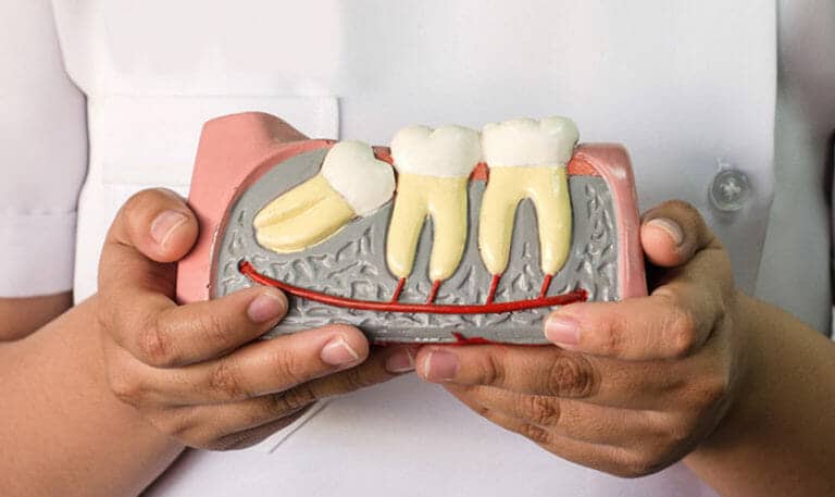 Featured image for “What are the Needs for Teeth Extraction?”